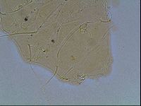 Echiniscus blumi image