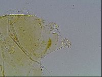 Echiniscus blumi image