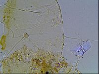 Echiniscus blumi image