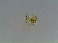 Echiniscus blumi image