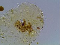 Echiniscus blumi image
