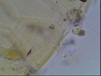 Echiniscus blumi image
