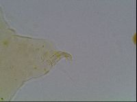 Echiniscus blumi image