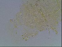 Echiniscus blumi image