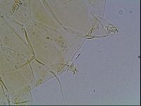 Echiniscus blumi image
