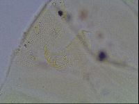 Echiniscus blumi image