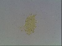 Echiniscus blumi image