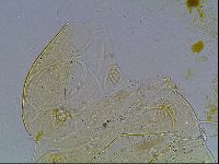 Echiniscus blumi image