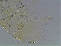 Echiniscus blumi image
