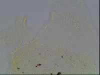 Echiniscus blumi image