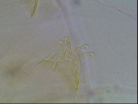 Echiniscus blumi image