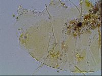 Echiniscus blumi image