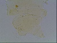 Echiniscus blumi image