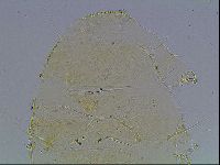 Echiniscus blumi image