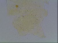 Echiniscus blumi image