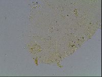 Echiniscus blumi image