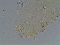 Echiniscus blumi image