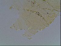 Echiniscus blumi image