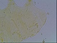 Echiniscus blumi image