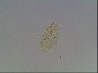 Echiniscus blumi image