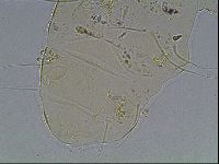 Echiniscus blumi image