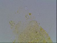 Echiniscus blumi image