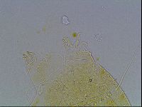 Echiniscus blumi image