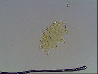 Echiniscus blumi image
