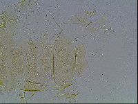 Echiniscus blumi image