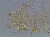 Echiniscus blumi image