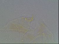 Echiniscus blumi image