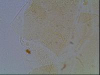 Echiniscus blumi image