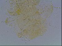 Echiniscus blumi image