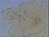 Echiniscus blumi image