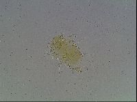 Echiniscus blumi image