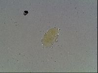 Echiniscus blumi image