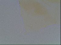 Echiniscus blumi image
