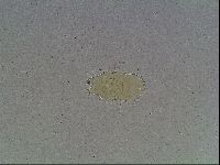 Echiniscus blumi image