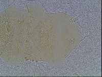 Echiniscus blumi image