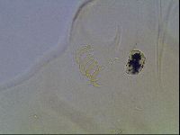 Echiniscus blumi image