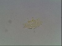 Echiniscus blumi image