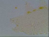 Echiniscus blumi image