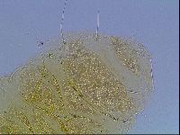 Echiniscus blumi image
