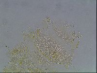 Echiniscus blumi image