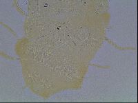 Echiniscus blumi image