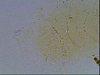 Echiniscus blumi image