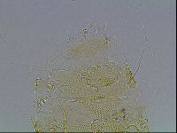 Echiniscus blumi image
