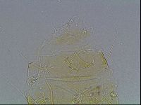Echiniscus blumi image