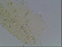 Echiniscus blumi image