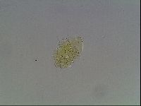 Echiniscus blumi image